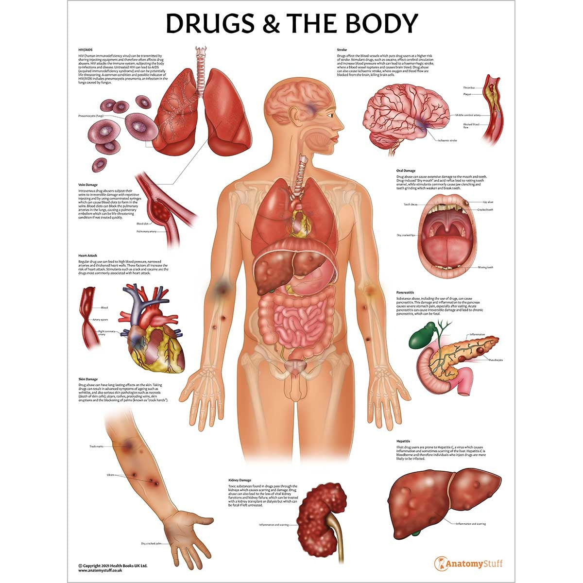 Drugs and The Body Laminated Chart / Poster (DRGBDY)