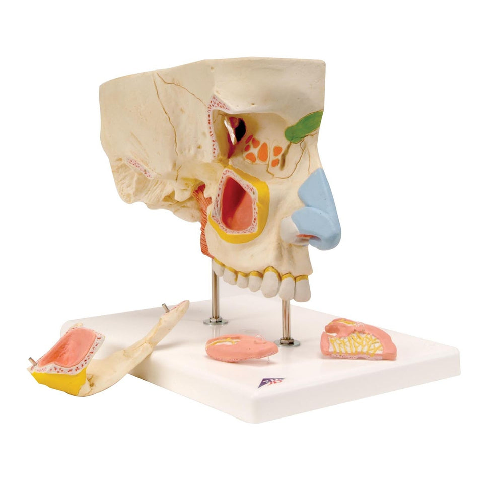 Nose Model with Paranasal Sinuses (5 part)