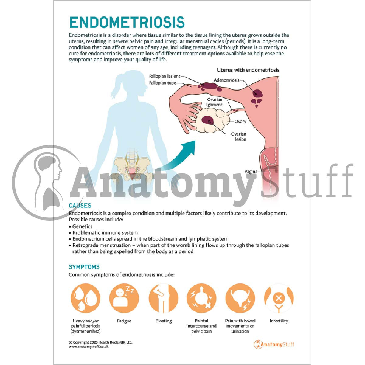 Endometriosis Patient Education Handout (Printable PDF)