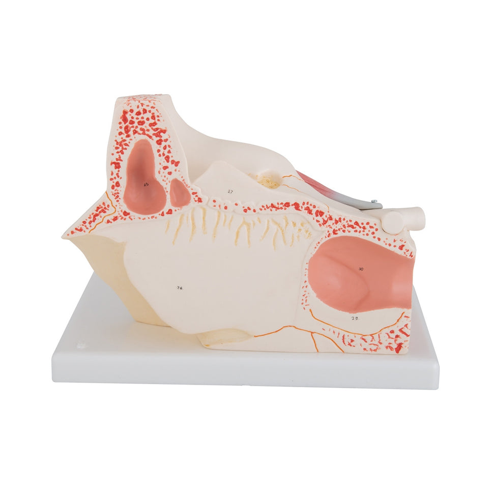 Eye Model in Bony Orbit (3 times life size, 7 part)