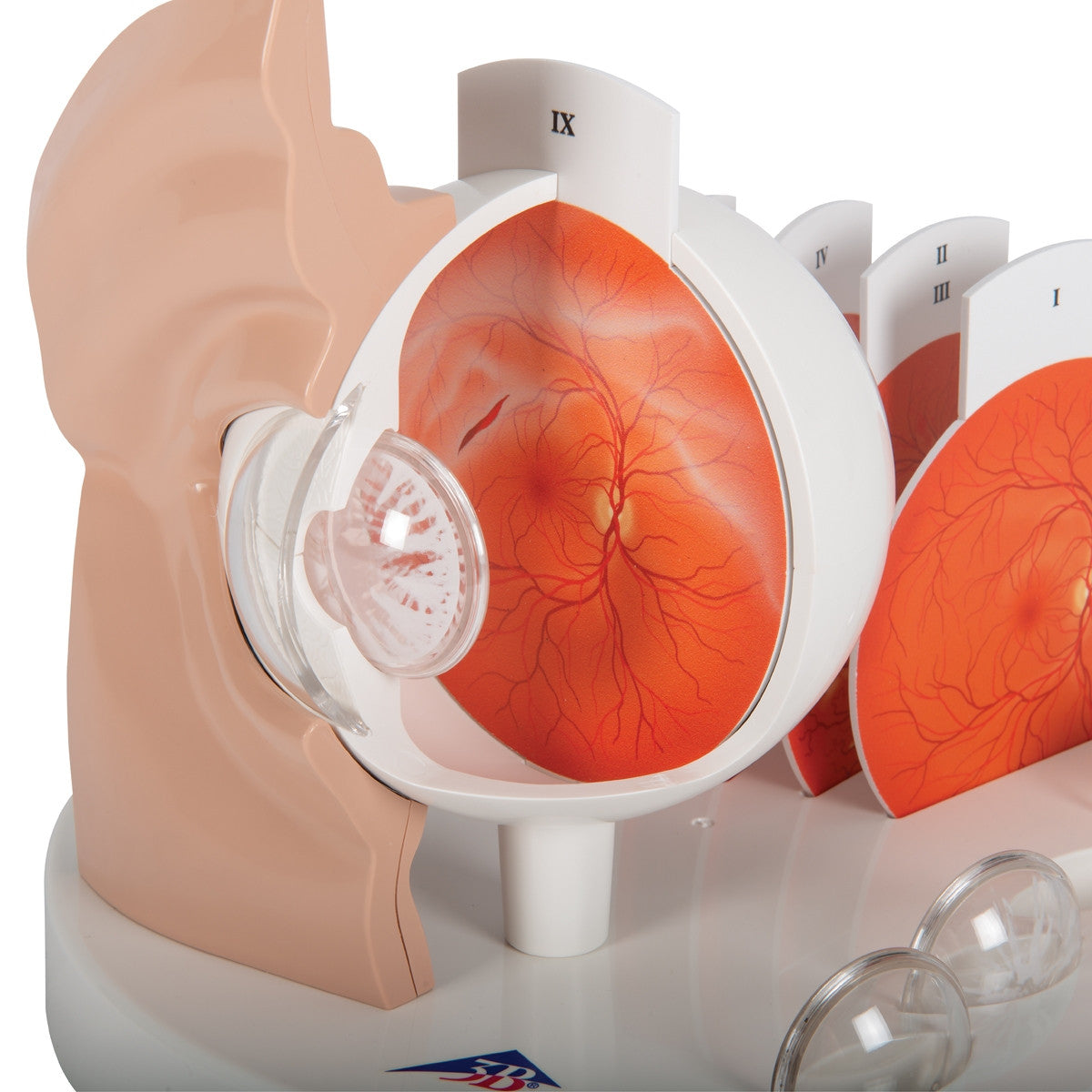 Pathological Eye Model