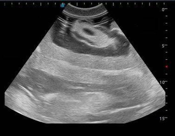 Femoral Arteriovenous Puncture and Abdominocentesis Ultrasound Training Model