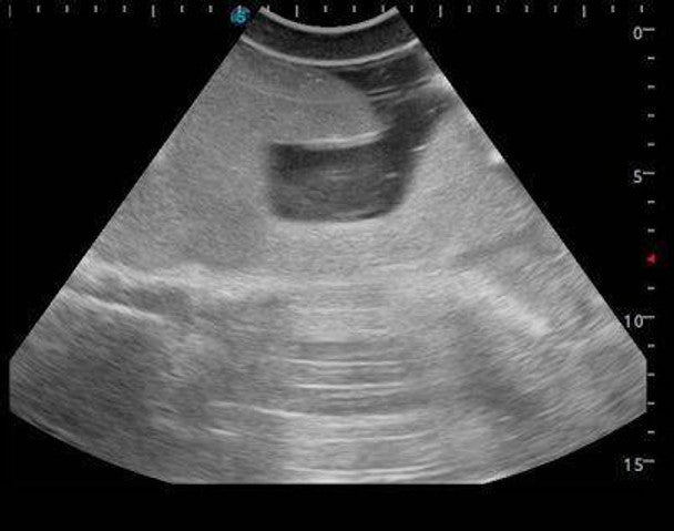 Femoral Arteriovenous Puncture and Abdominocentesis Ultrasound Training Model