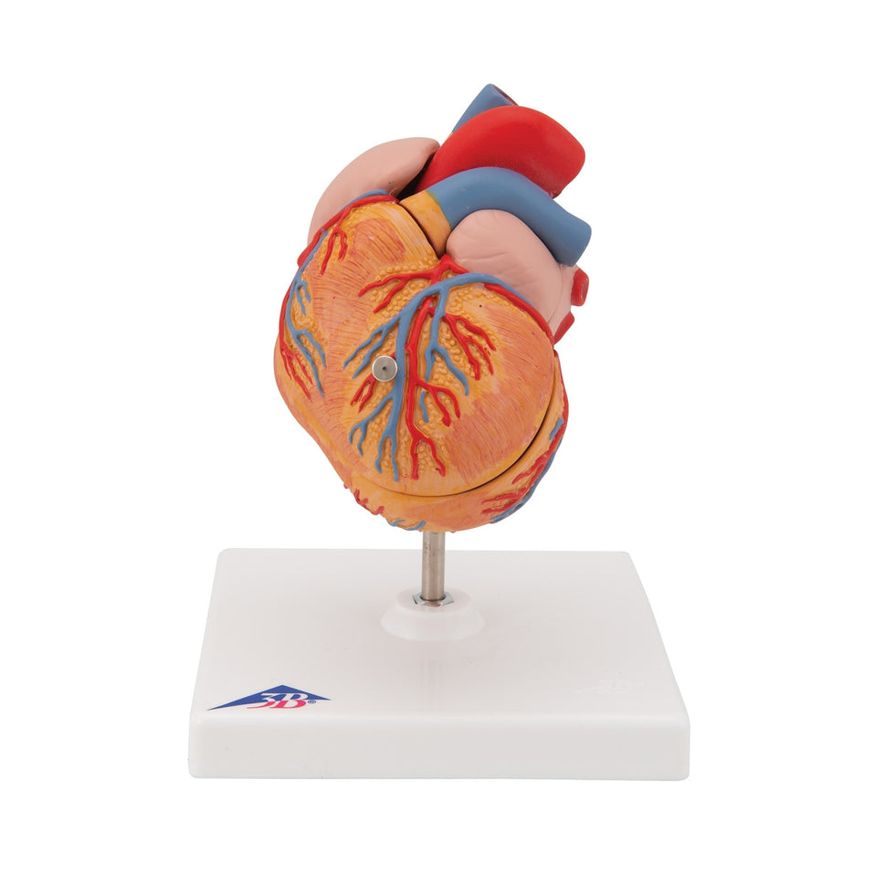 Heart Model with Left Ventricular Hypertrophy (2 part)