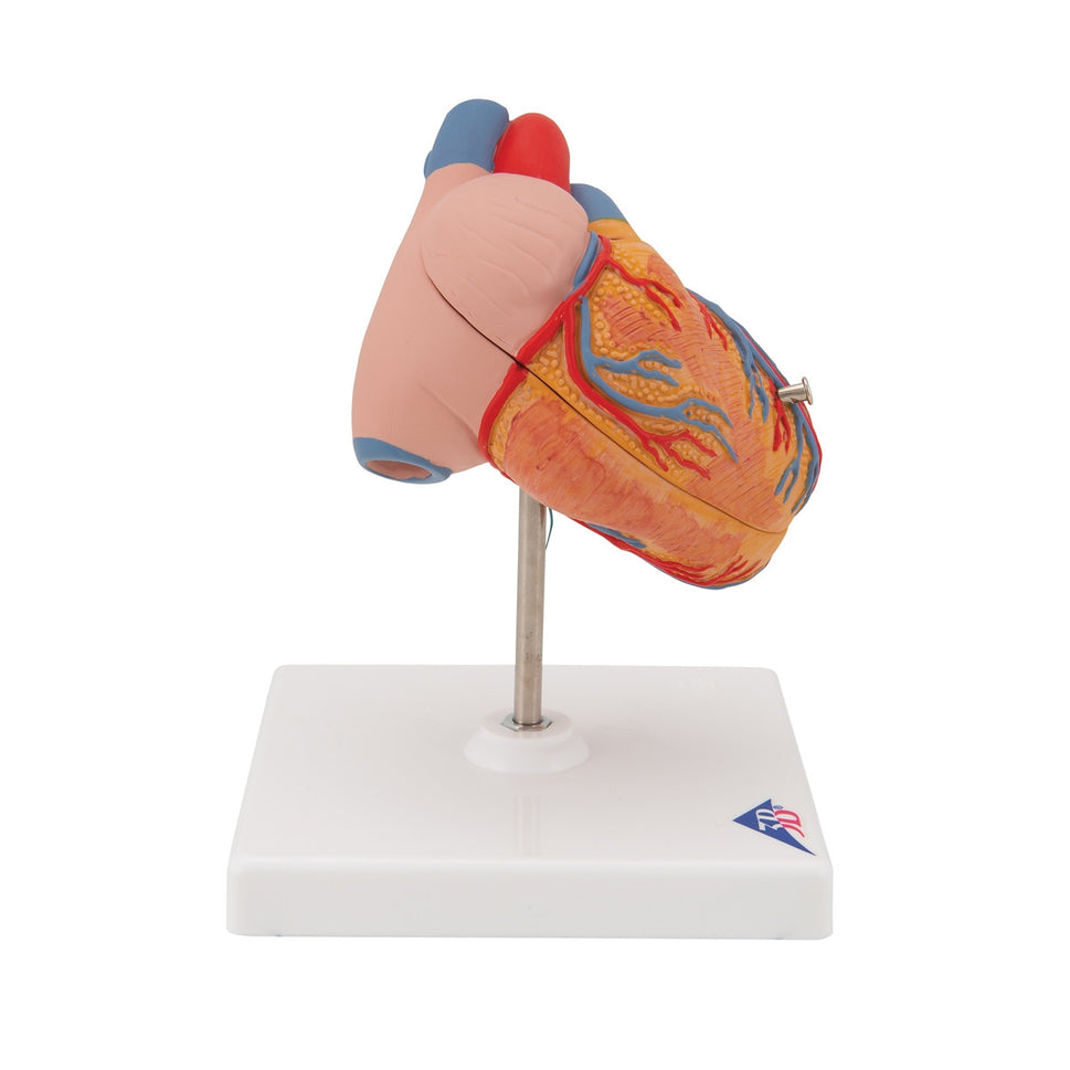 Heart Model with Left Ventricular Hypertrophy (2 part)