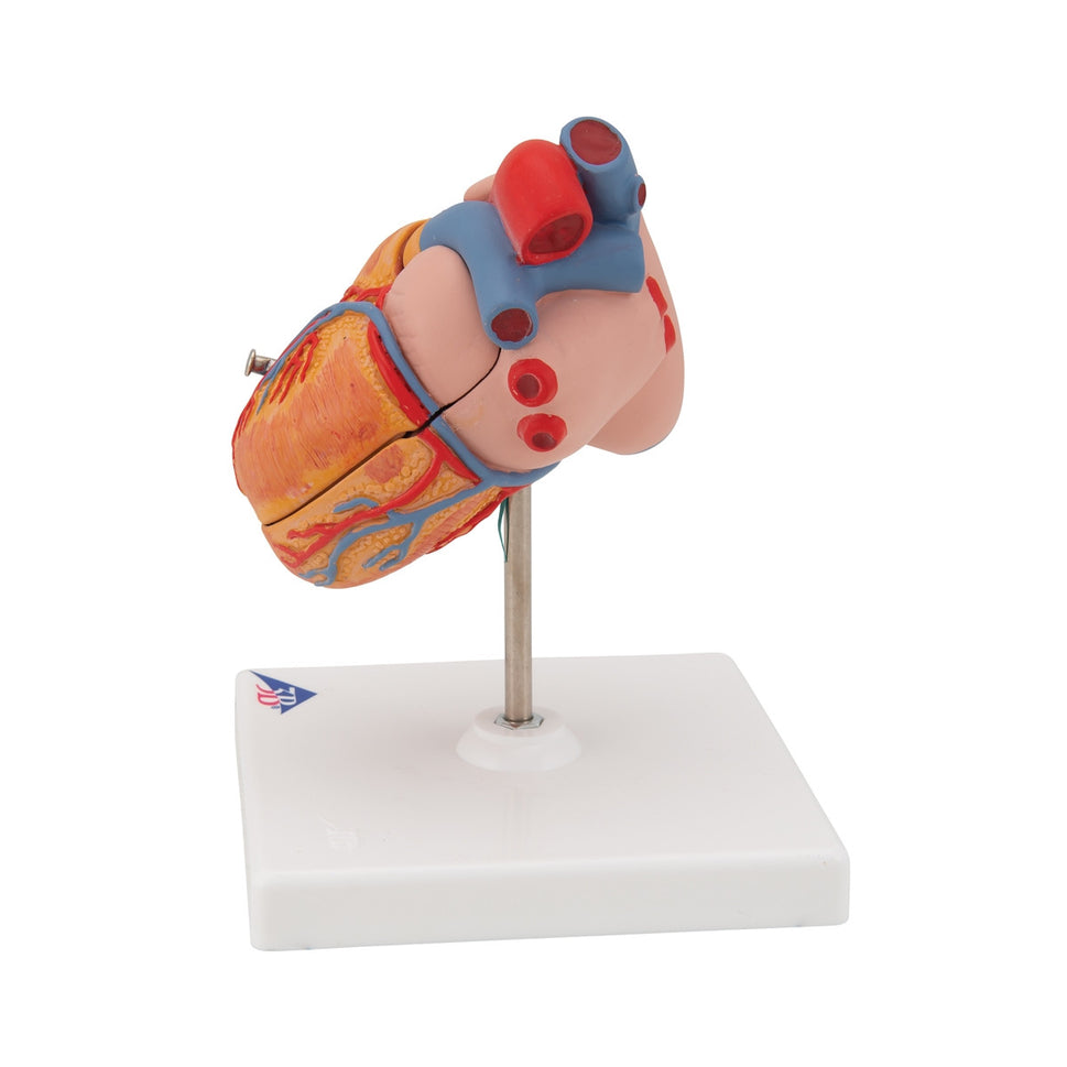 Heart Model with Left Ventricular Hypertrophy (2 part)