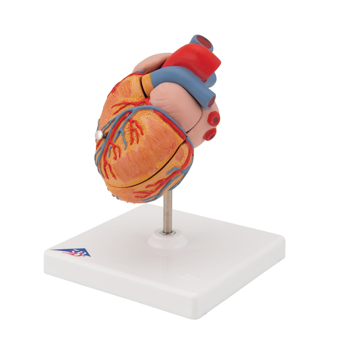 Heart Model with Left Ventricular Hypertrophy (2 part)