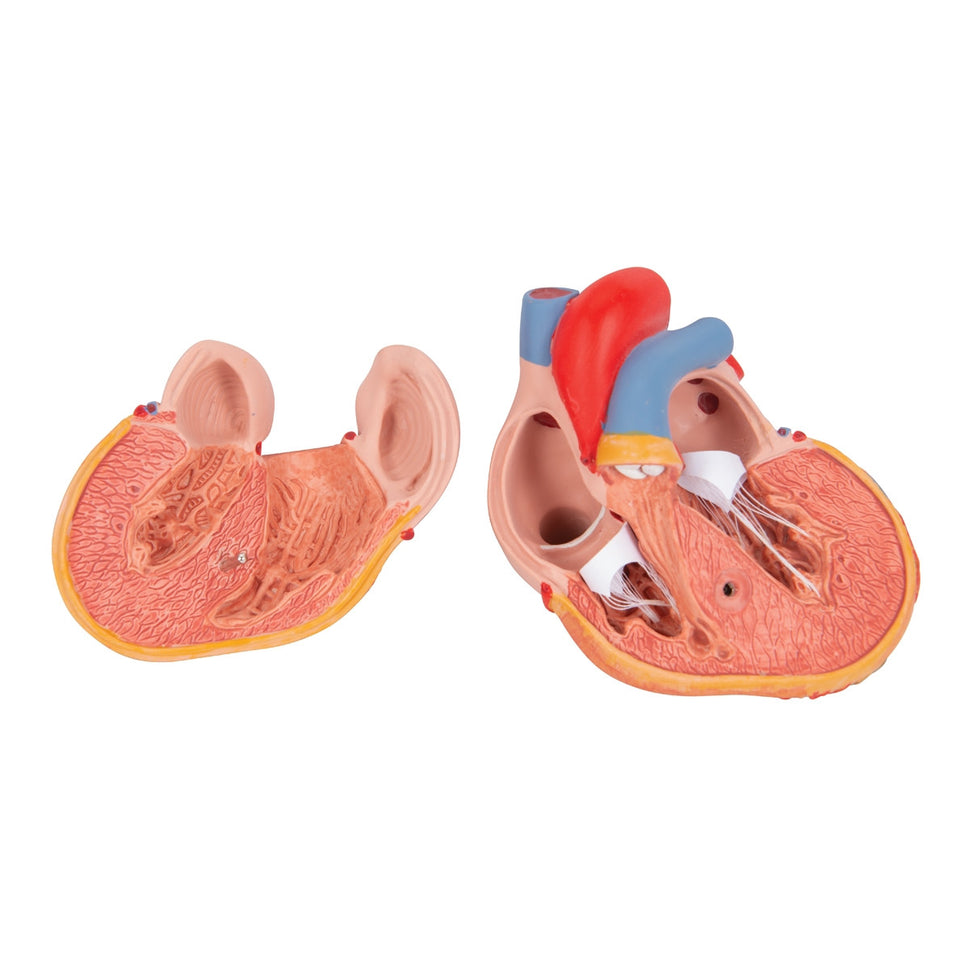Heart Model with Left Ventricular Hypertrophy (2 part)
