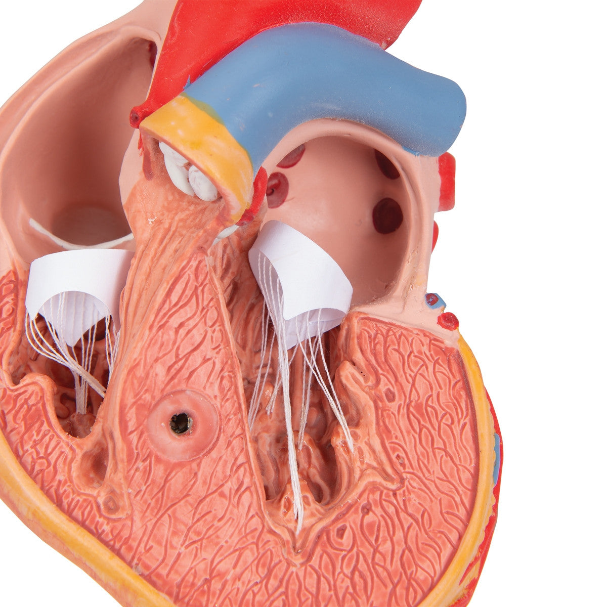 Heart Model with Left Ventricular Hypertrophy (2 part)