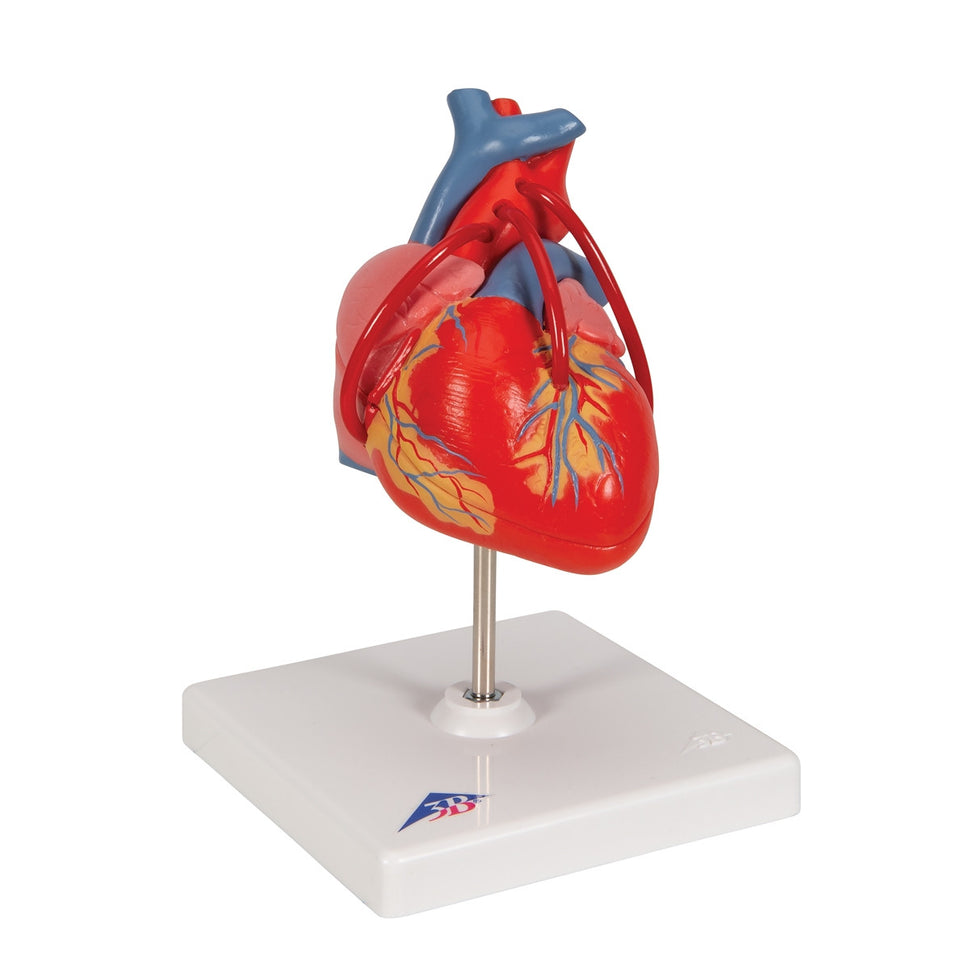 Heart Bypass Model (2 part)