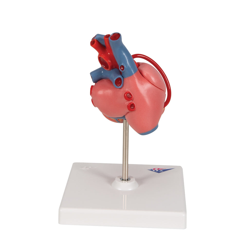 Heart Bypass Model (2 part)