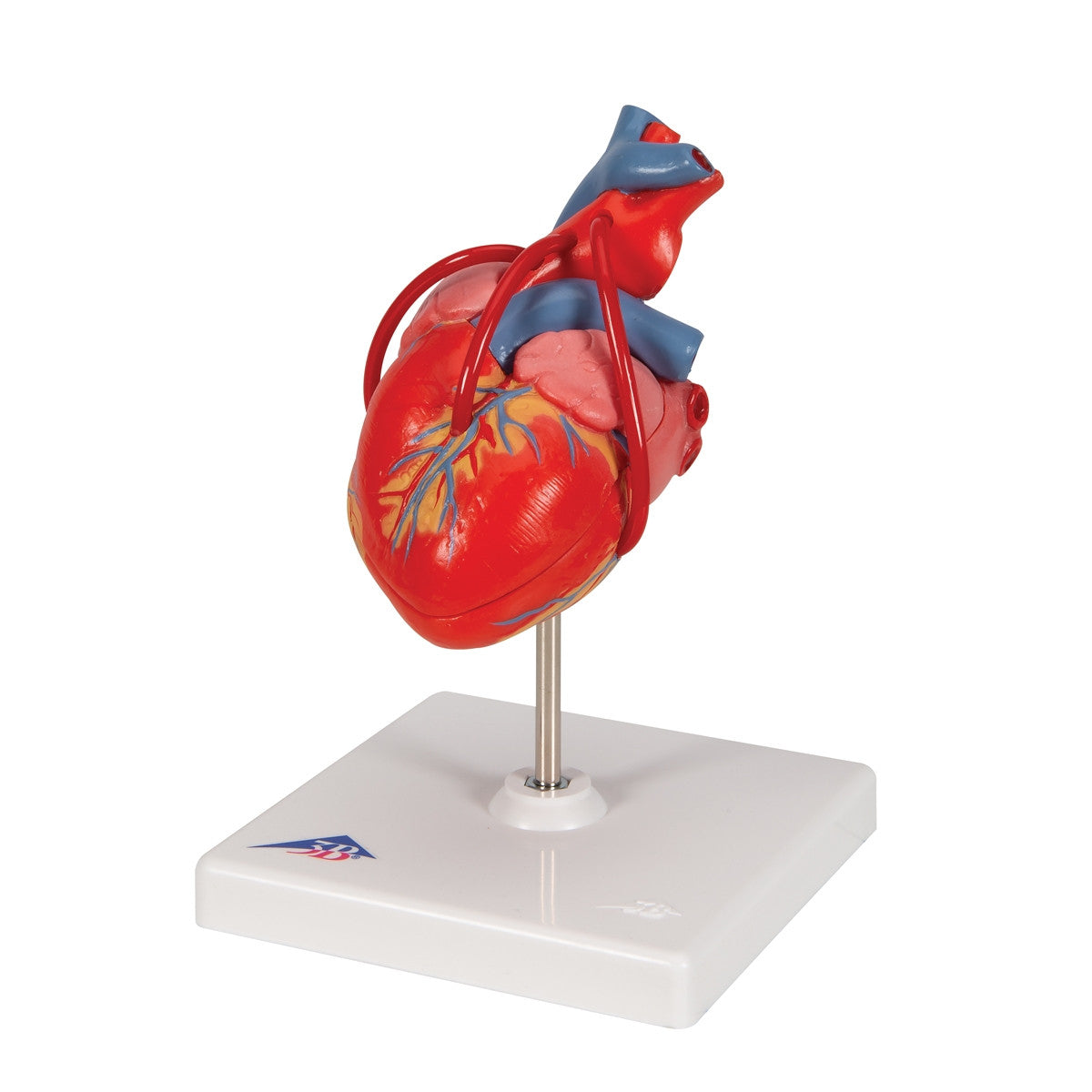 Heart Bypass Model (2 part)