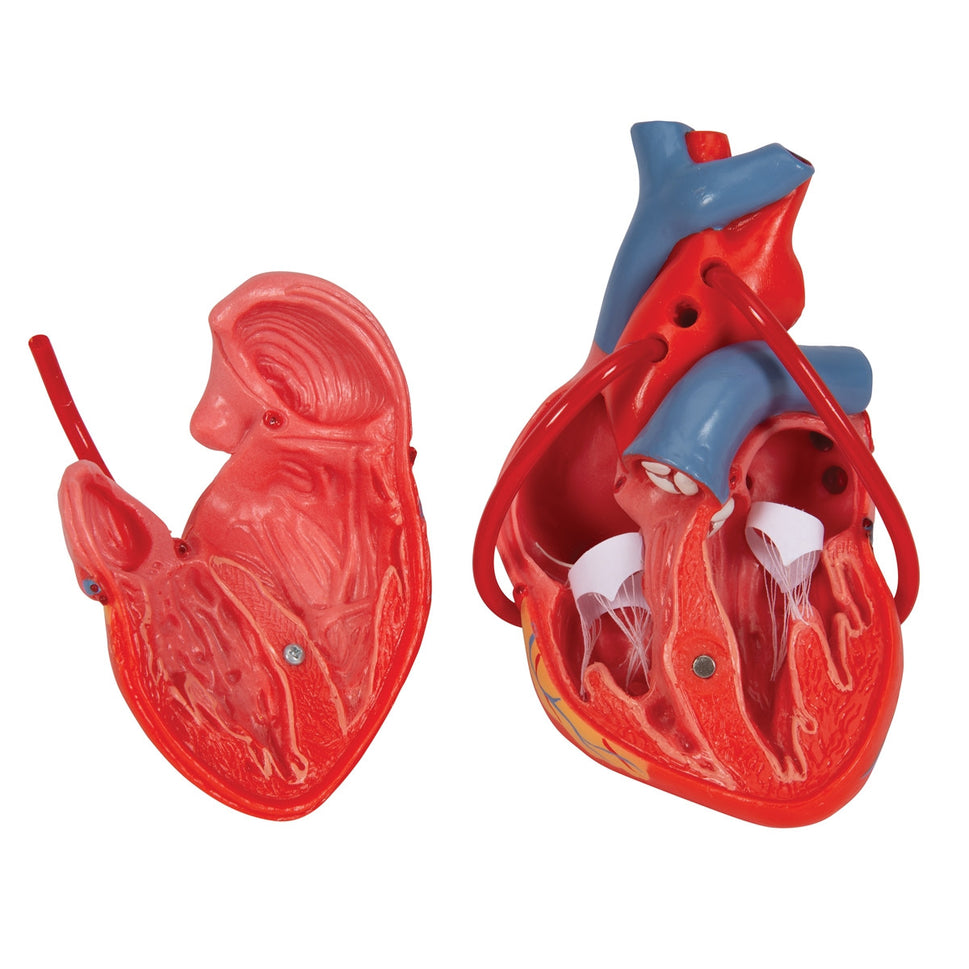 Heart Bypass Model (2 part)