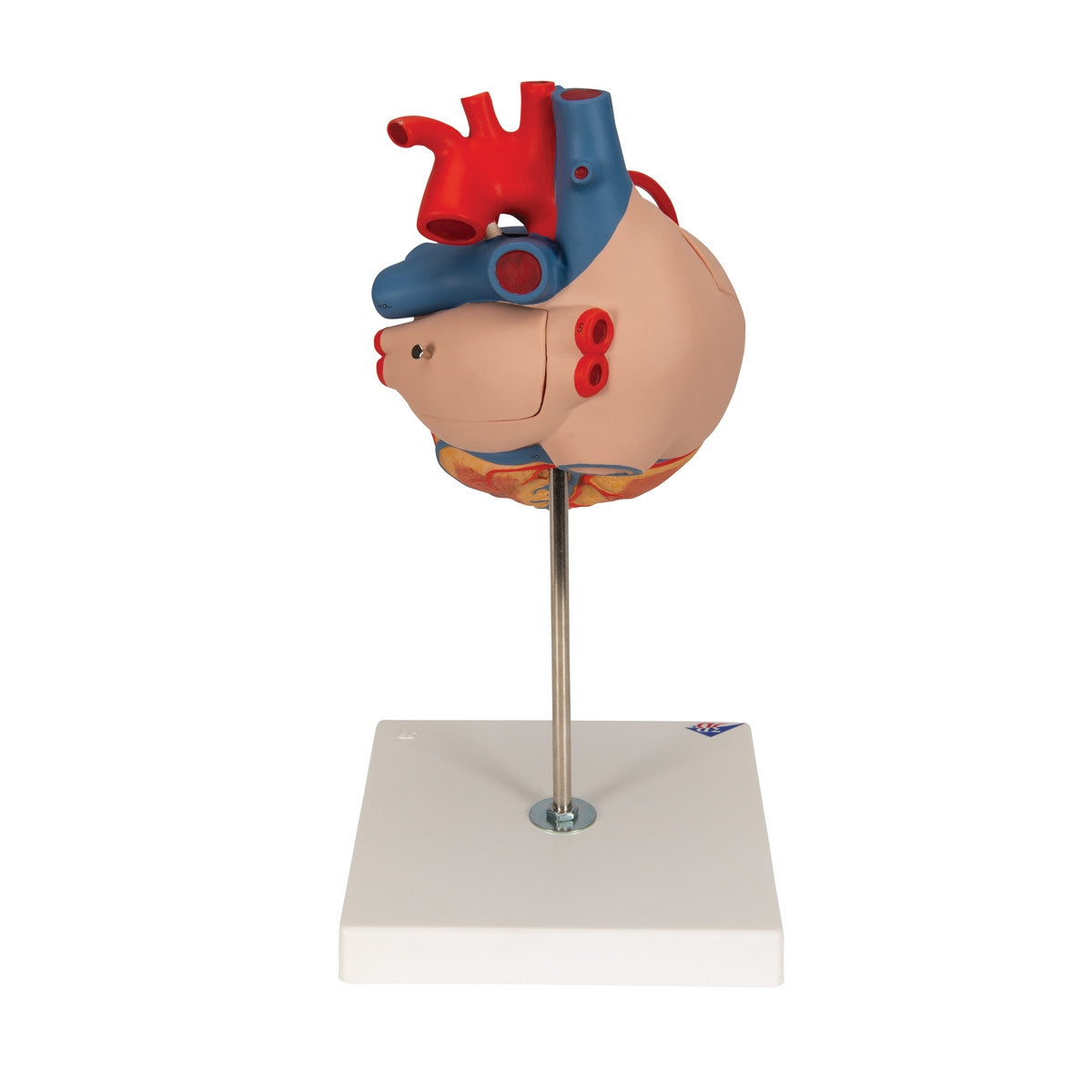Giant Heart with Bypass Model (2 times life size, 4 part)