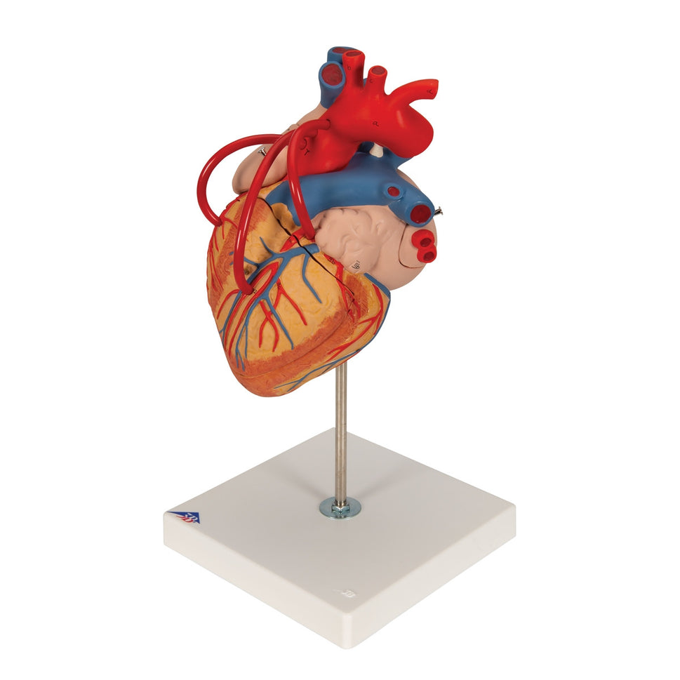 Giant Heart with Bypass Model (2 times life size, 4 part)