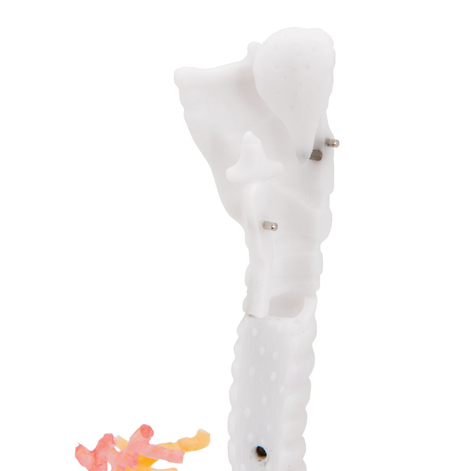 CT Bronchial Tree with Larynx and Transparent Lung Model