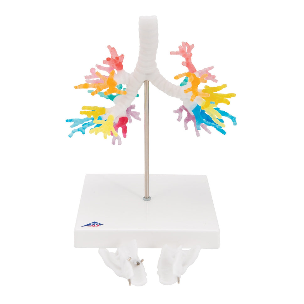 CT Bronchial Tree with Larynx Model
