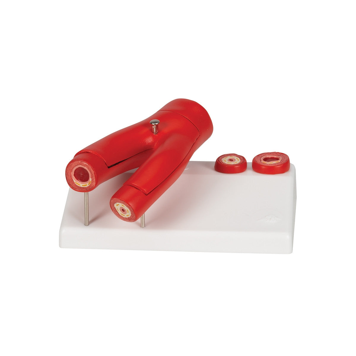 Atherosclerosis Cross Section Model (2 part)