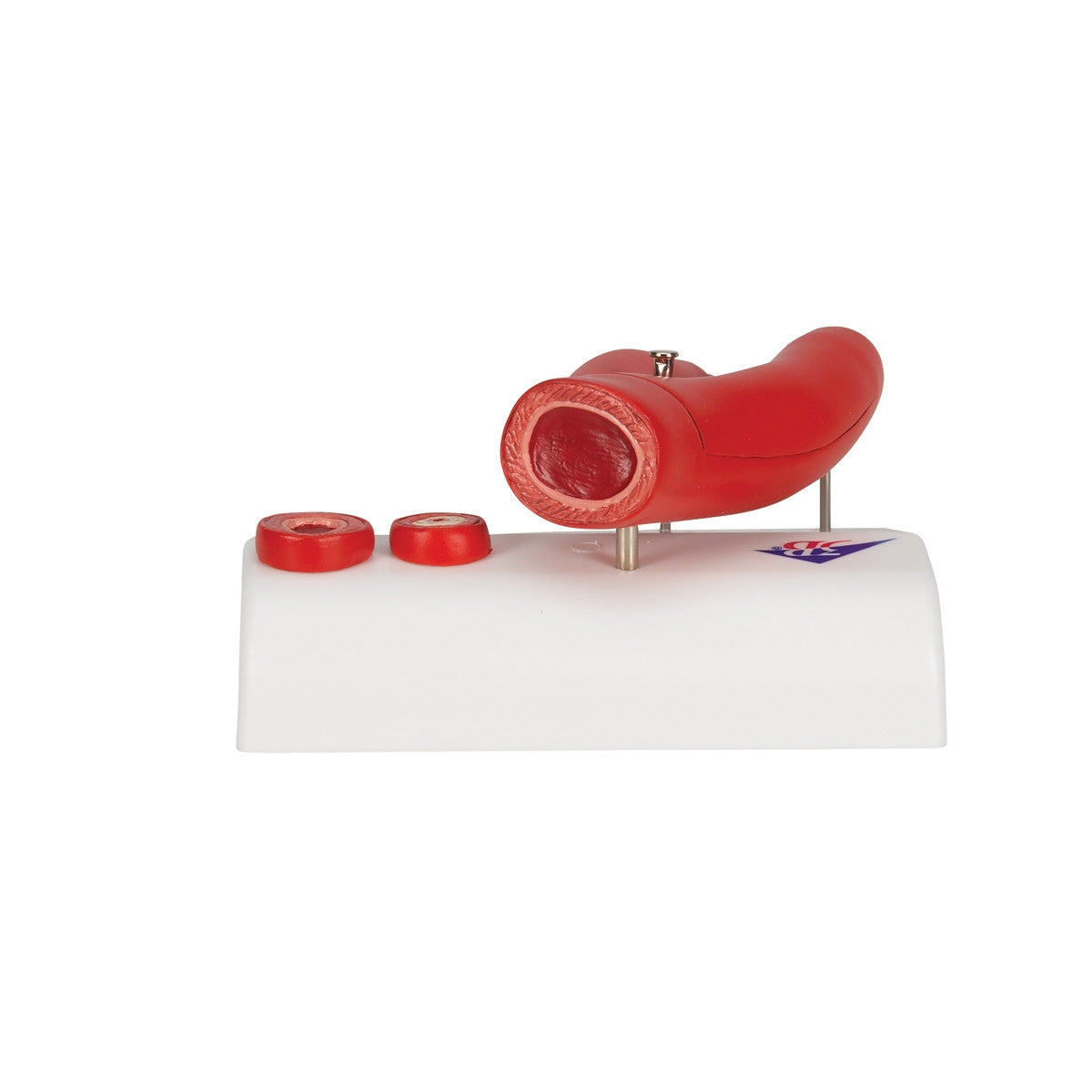 Atherosclerosis Cross Section Model (2 part)