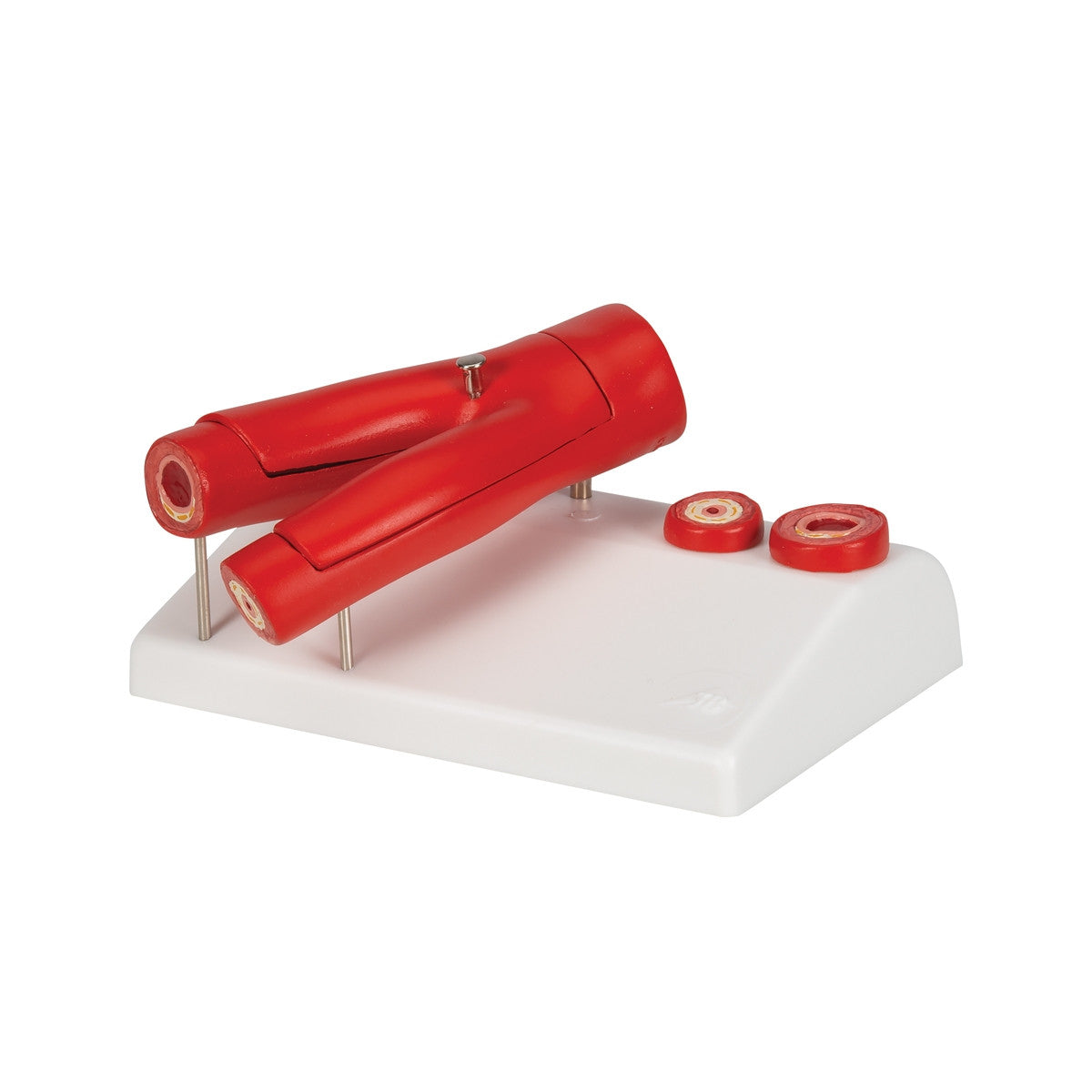 Atherosclerosis Cross Section Model (2 part)