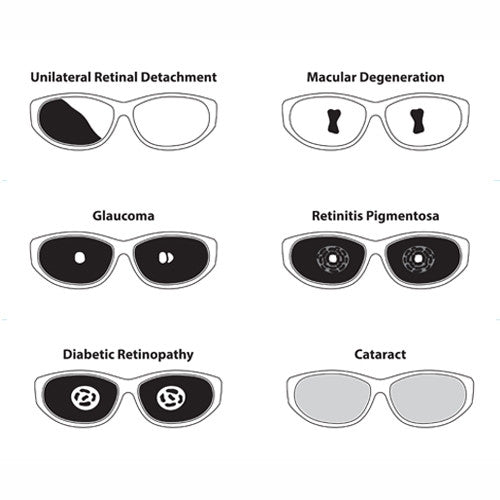 Geriatric Simulator 10920344 - Eyesight Simulation