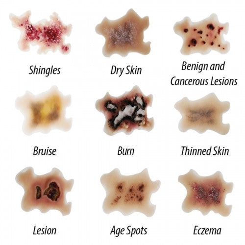 Geriatric Skin Conditions Simulation Set