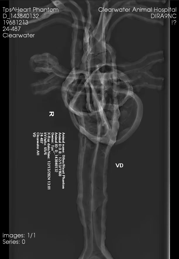 Adult Heart Phantom for X-Ray CT, US, MRI