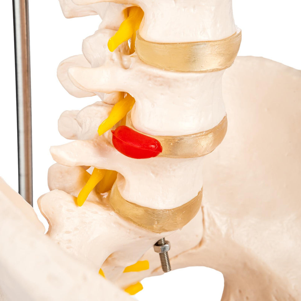 Budget Flexible Spine Model with Pelvis and Femoral Heads