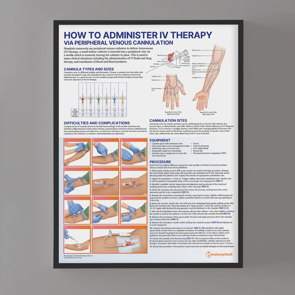 IV Therapy Chart / Poster