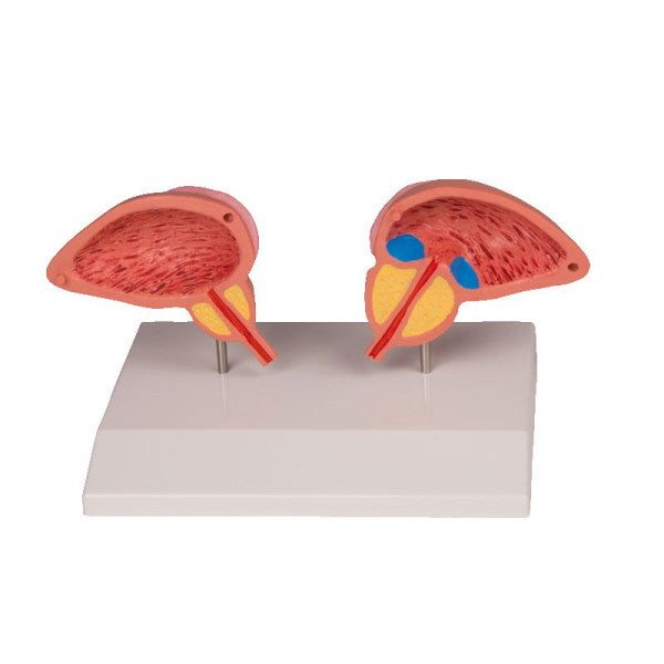 Prostate Model (2 part)