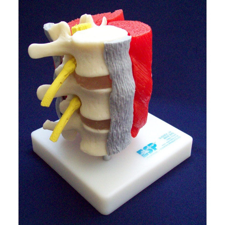 Lumbar Vertebrae With Muscles Model