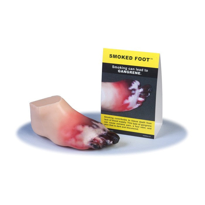 Smoked Foot Gangrene Model