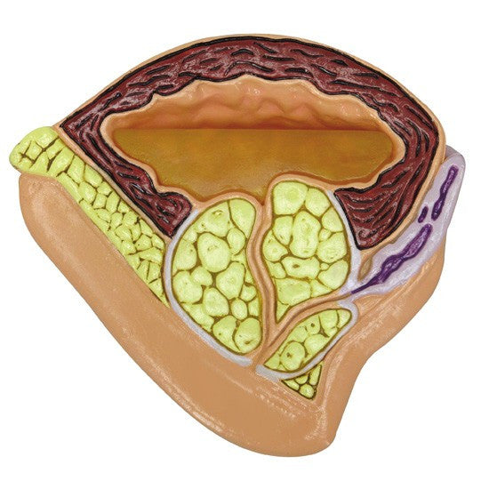 Male Pelvis Section Model with BPH