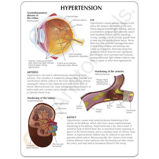 Hypertension Model Set