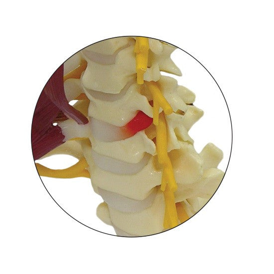 Realistic spinal model with a soft cerebellum, the right brachial plexus and herniated discs