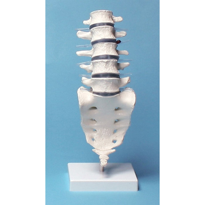 Lumbar Spine Model 1