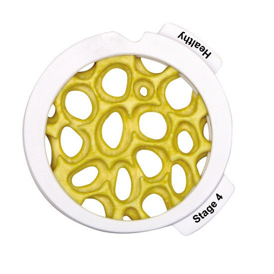 Osteoporosis Hinged Disc Set (4 Piece)