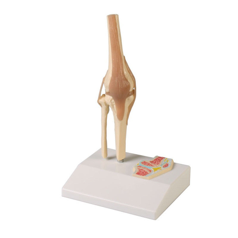Miniature Knee Joint Model with Cross Section