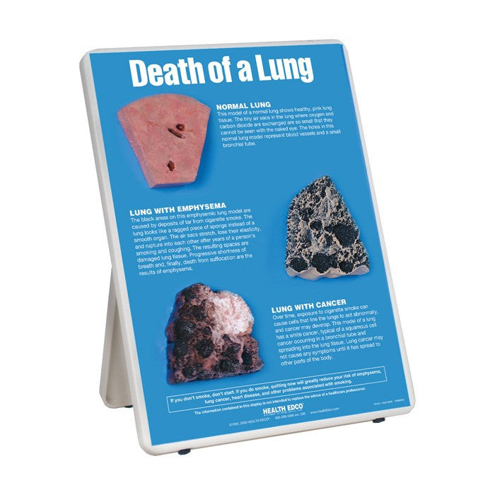 Death of a Lung Easel Display