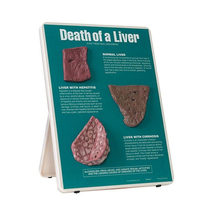 Death of a Liver Easel Display