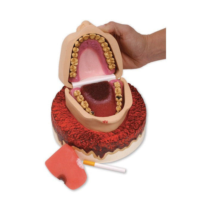 Smoker's Foul Mouth Display