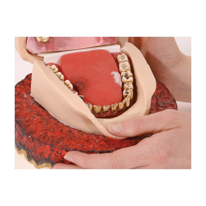 Smoker's Foul Mouth Display