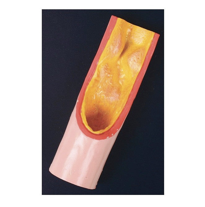 Benefits Of Physical Activity 3D Display