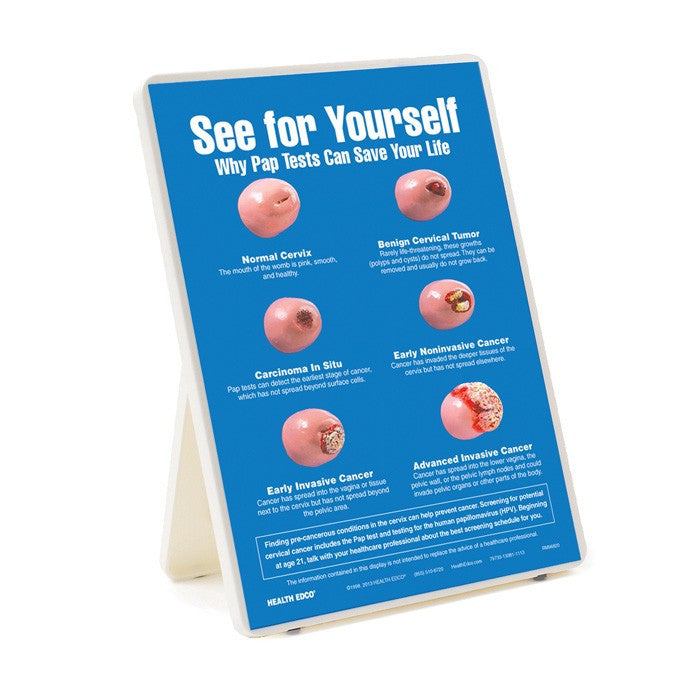 See For Yourself: Pap Tests Easel Display