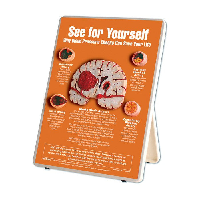 See For Yourself: Blood Pressure Checks Easel Display