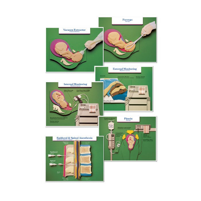 Labour and Birth Intervention Laminated Chart Set (Set of 6, English/Spanish)