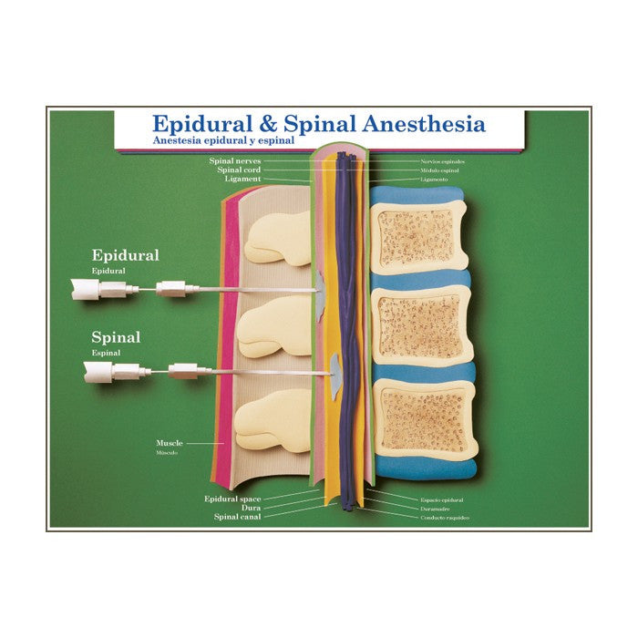 Labour and Birth Intervention Laminated Chart Set (Set of 6, English/Spanish)