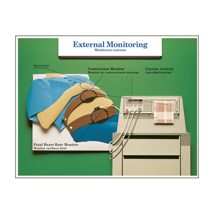 Labour and Birth Intervention Laminated Chart Set (Set of 6, English/Spanish)