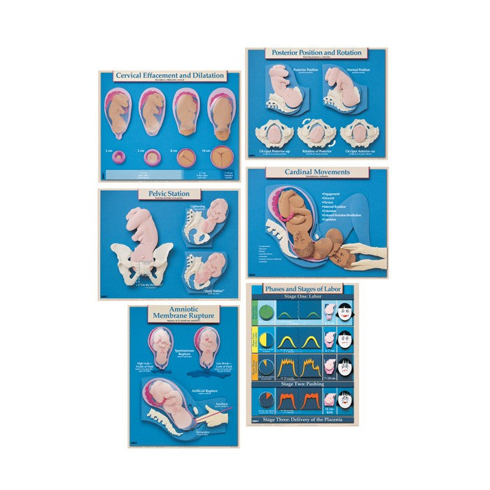 Essential Labour and Birth Laminated Chart Set (Set of 6, English/Spanish)
