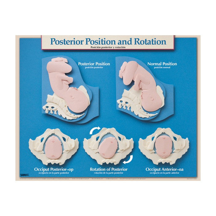 Essential Labour and Birth Laminated Chart Set (Set of 6, English/Spanish)